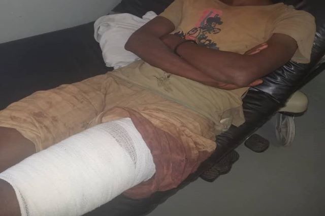 Lualaba: un creuseur clandestin atteint par une balle dans la concession TFM