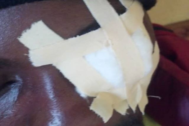 Kolwezi : la Société Civile porte plainte contre un chinois, blessures et maltraitance contre un creuseur
