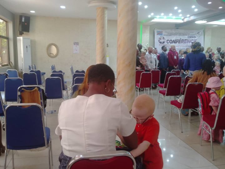 RDC: Christine perd son mariage pour avoir mis au monde 2 albinos