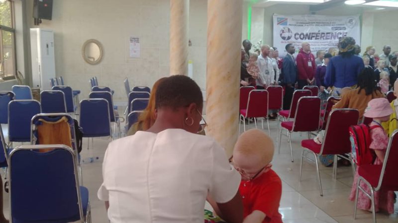 RDC: Christine perd son mariage pour avoir mis au monde 2 albinos