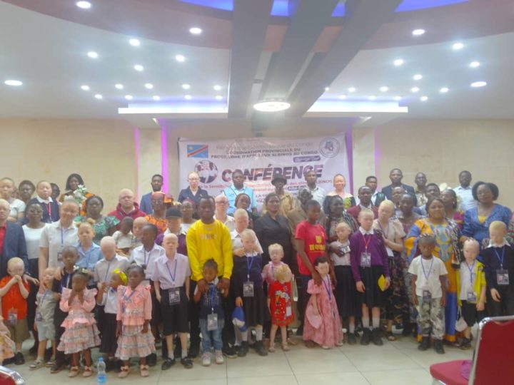 Lubumbashi : Albi-school, un projet en faveur des élèves albinos