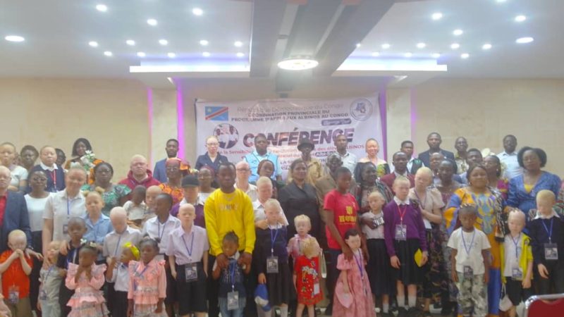 Lubumbashi : Albi-school, un projet en faveur des élèves albinos