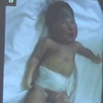 Les maladies imputables aux activités minières