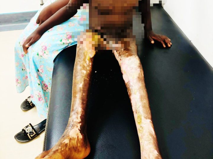 Lubumbashi: deux ans après l&rsquo;incendie une mère appelle à l&rsquo;aide