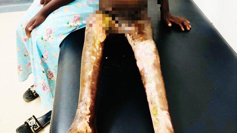 Lubumbashi: deux ans après l&rsquo;incendie une mère appelle à l&rsquo;aide