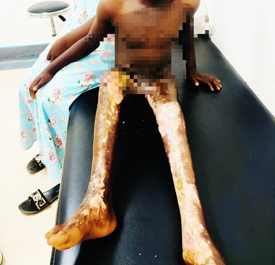 Lubumbashi: deux ans après l&rsquo;incendie,une mère appelle à l&rsquo;aide