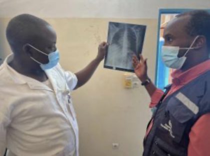 RDC: la tuberculose persiste encore