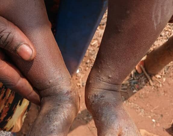 Lualaba: l’Ecole du Fleuve Congo et l’ADDL alertent sur les impacts environnementaux et sanitaires liés aux activités de Luilu Ressource à Noa