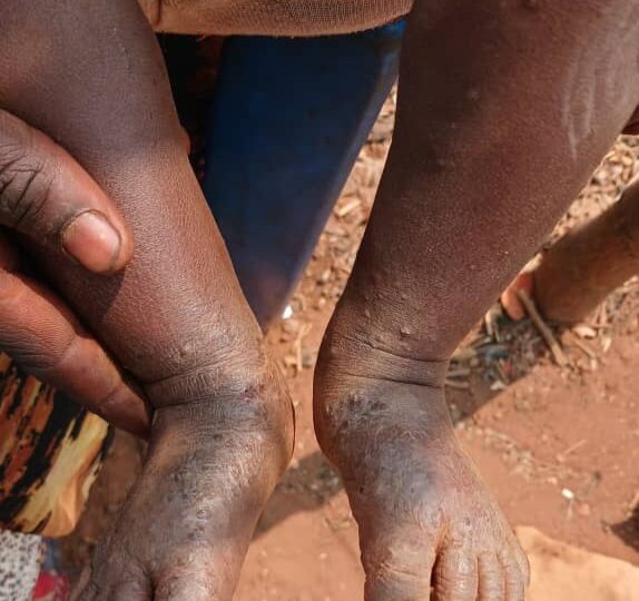 Lualaba: l’Ecole du Fleuve Congo et l’ADDL alertent sur les impacts environnementaux et sanitaires liés aux activités de Luilu Ressource à Noa