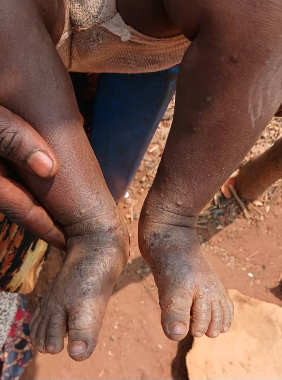 Lualaba: l’Ecole du Fleuve Congo et l’ADDL alertent sur les impacts environnementaux et sanitaires liés aux activités de Luilu Ressource à Noa